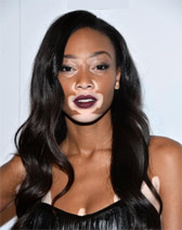 Winnie Harlow kimdir? Winnie Harlow